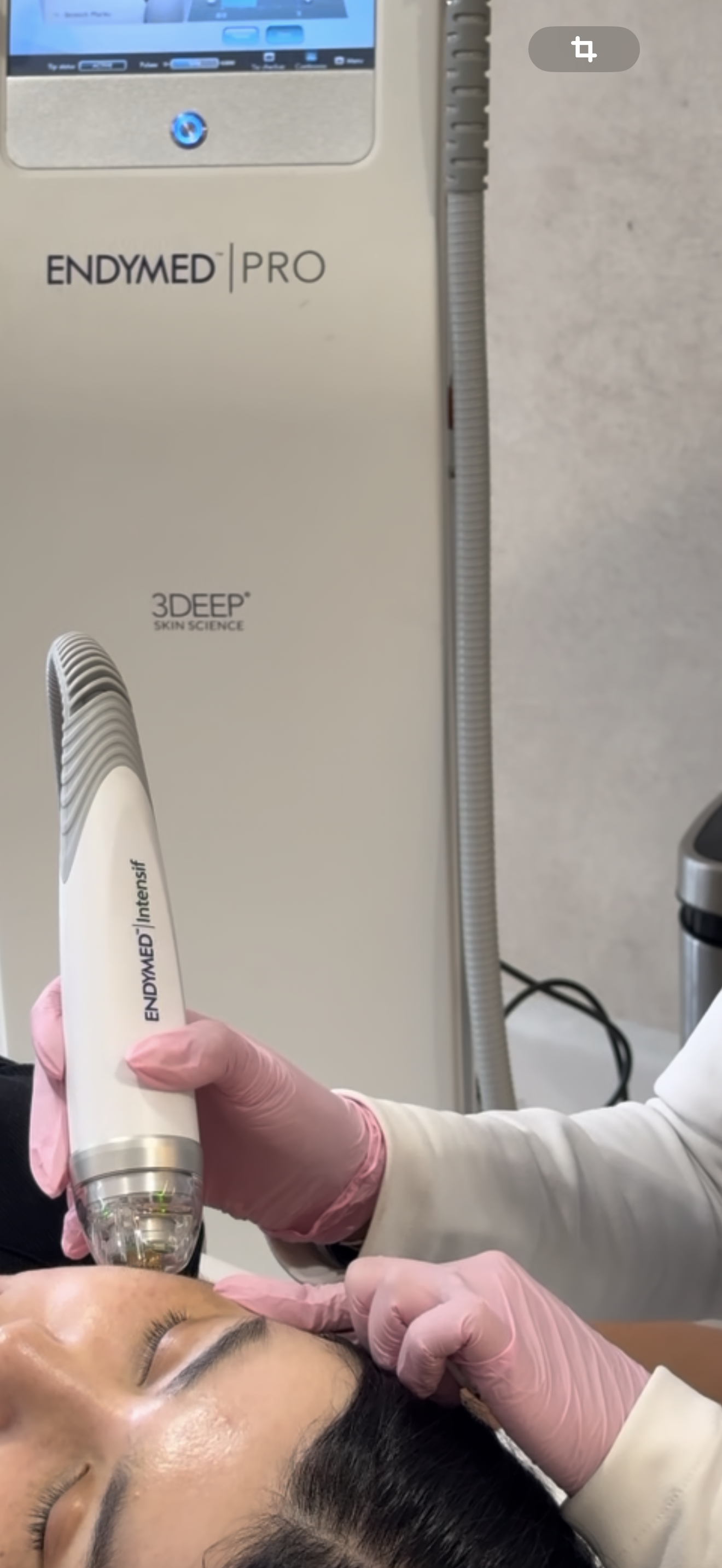 Radiofrecuencia Fraccionada con microagujas. Intensif de Endymed