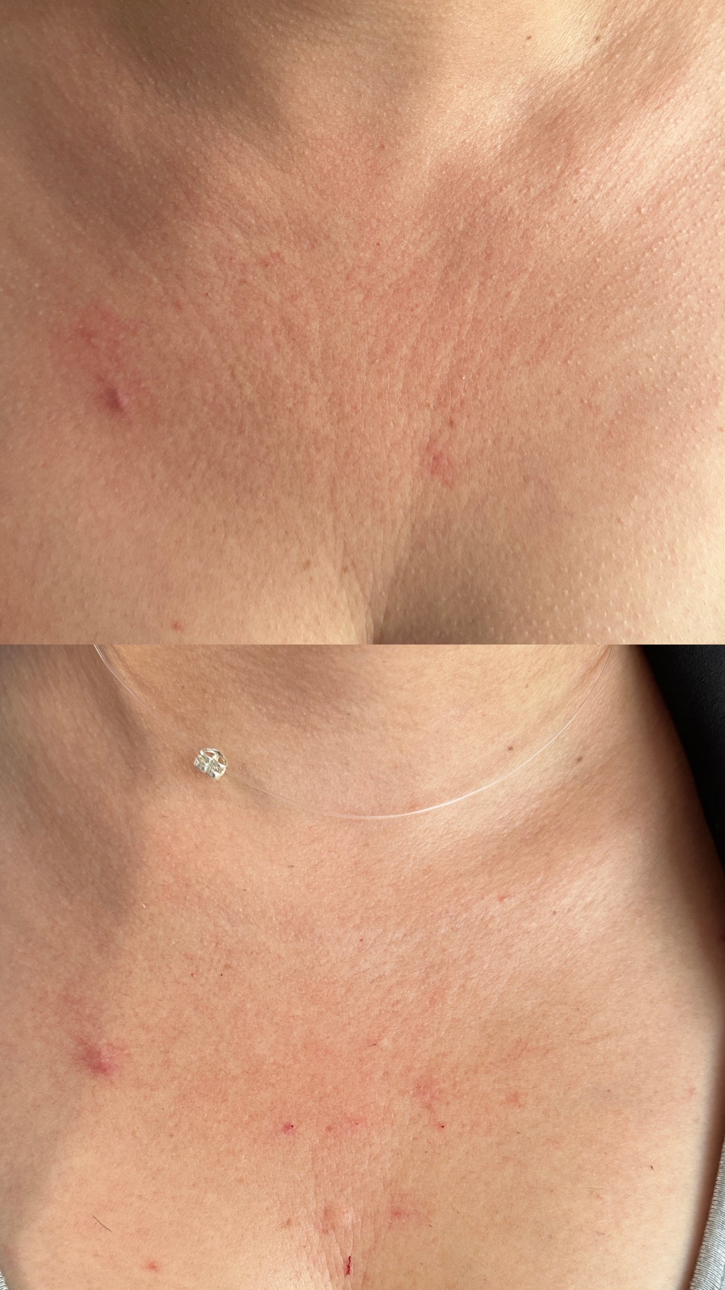 Skin Booster