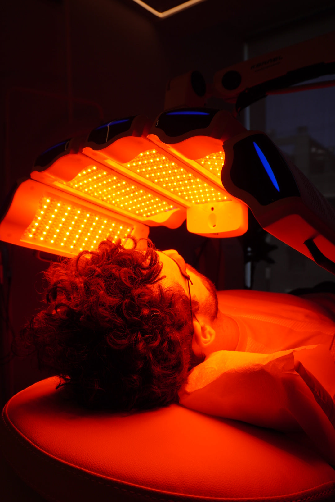 Rejuvenecimiento Periocular con Láser CO2 Tetra Pro de Deka (Italia)
