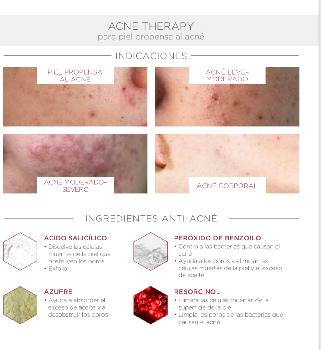 Acne Back & Chest Treatment Spray