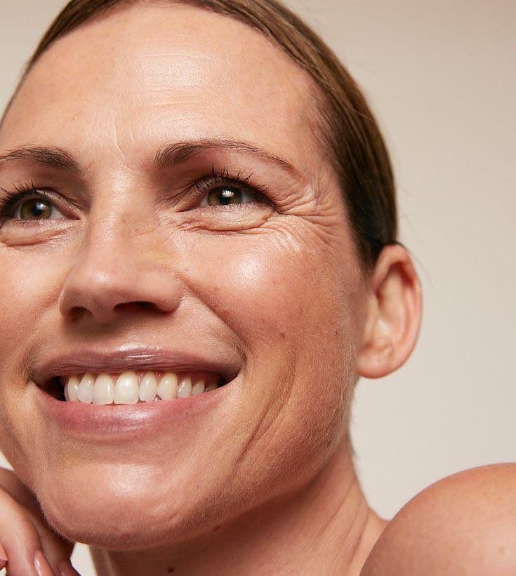 toxina boutulinica arrugas de expresion