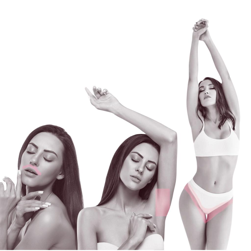 Pack Depilación Láser bozo + Rebaje parcial + axila (6 sesiones) • Láser Soprano Titanium