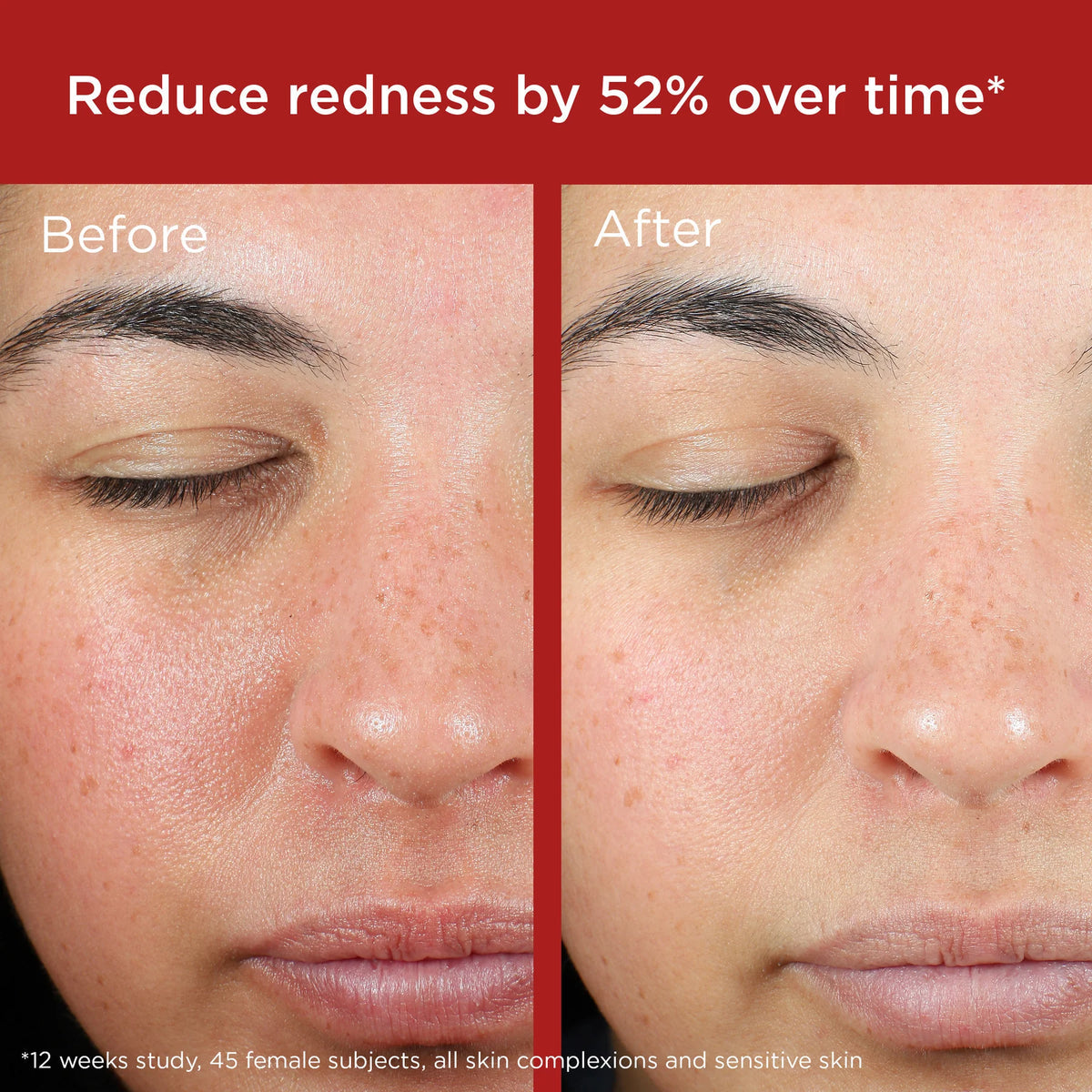 UV Skin Recovery SPF 50+ — Protector Solar Mineral para Pieles Sensibles y con Rosácea