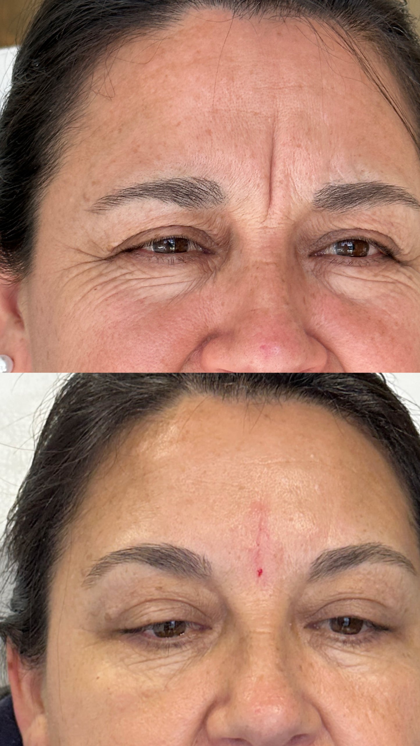 Skin Booster