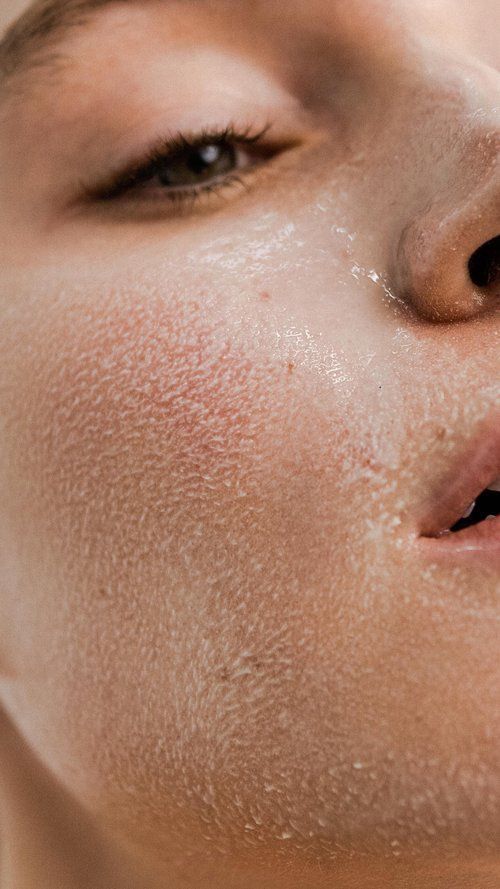 Acido Polilactico (PLA)