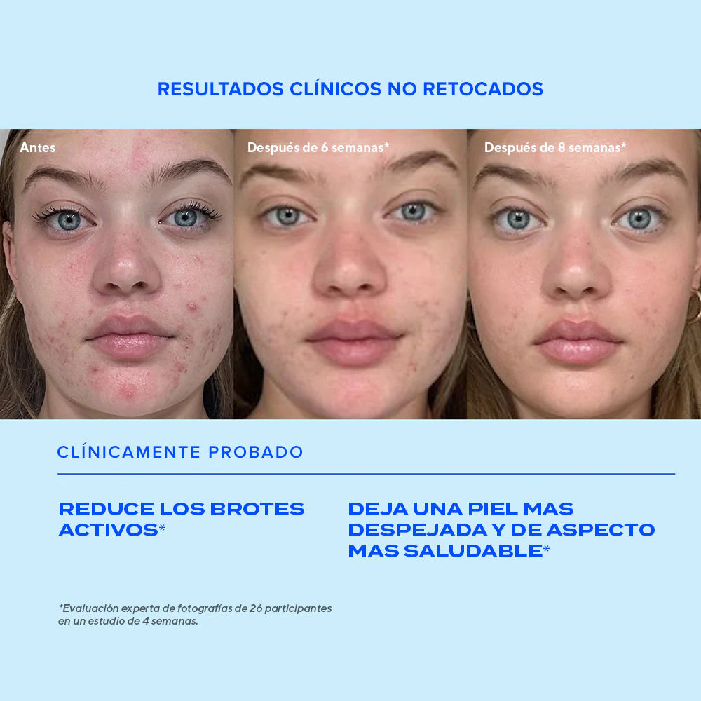 Biome-Balancing Clear & Prevent Serum - Anti-Imperfecciones 30ml
