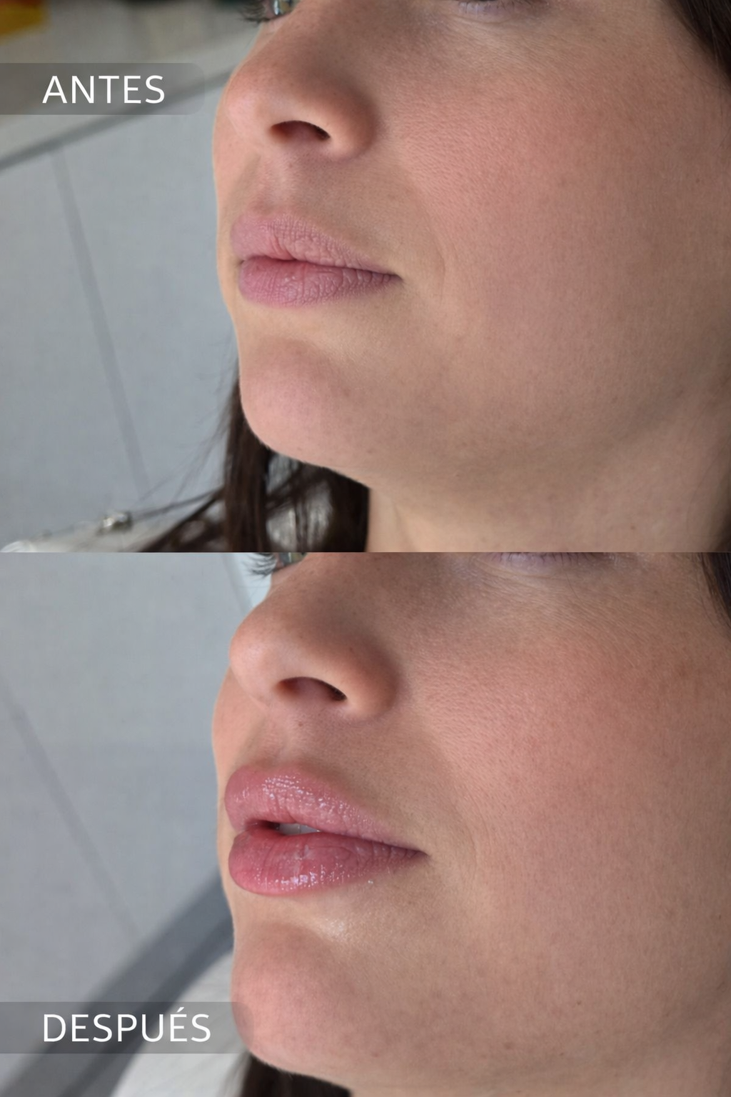 Labios lips by Dra Pia