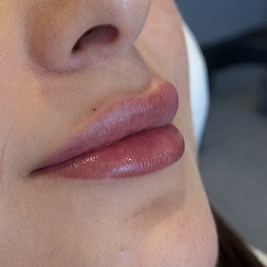 Labios lips by Dra Pia