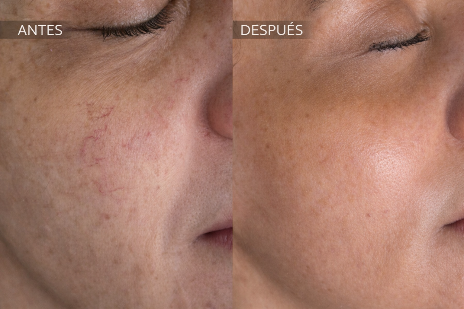 Plataforma Stellar M22 | IPL + NDYAG – The Beauty Lab
