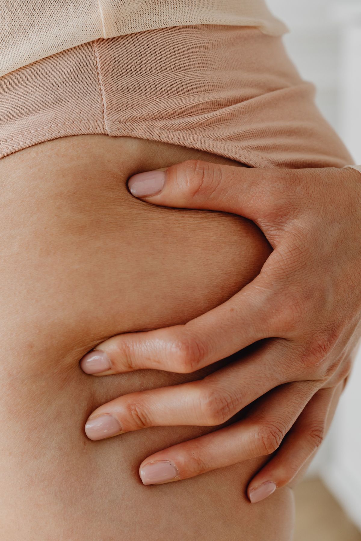 Tratamiento de Estrías con Láser CO2