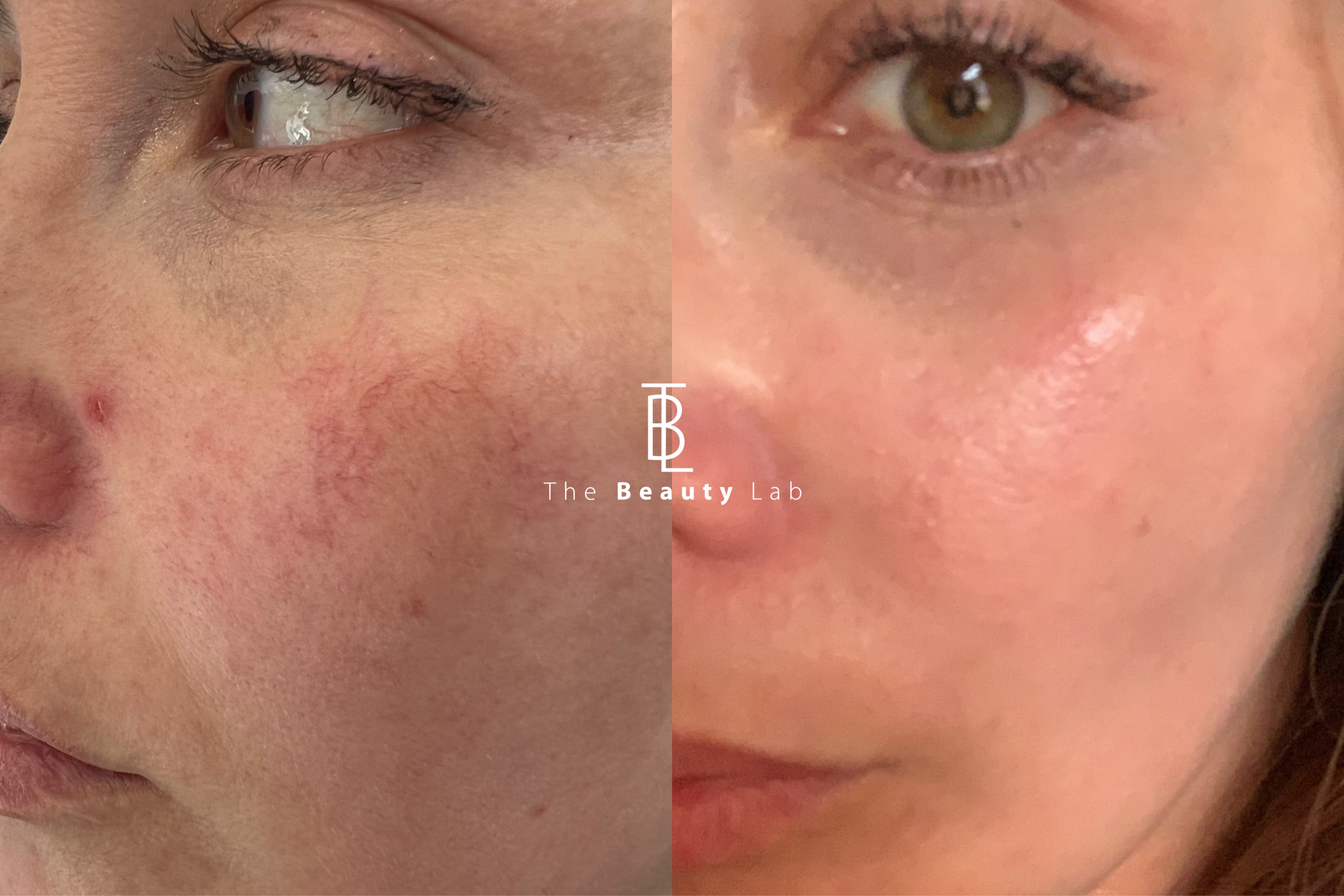 Plataforma Stellar M22 | IPL + NDYAG – The Beauty Lab