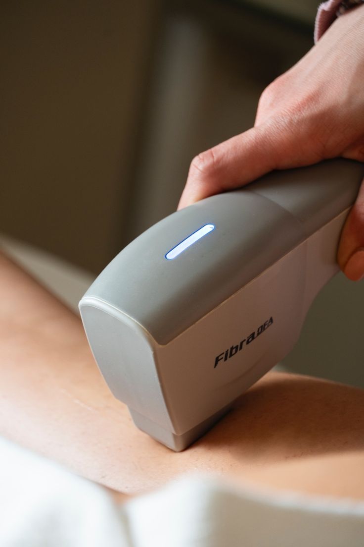 La plataforma Stellas M22